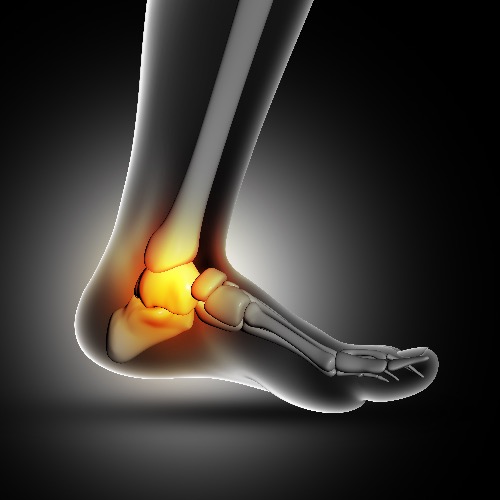 ankle replacement resized 1
