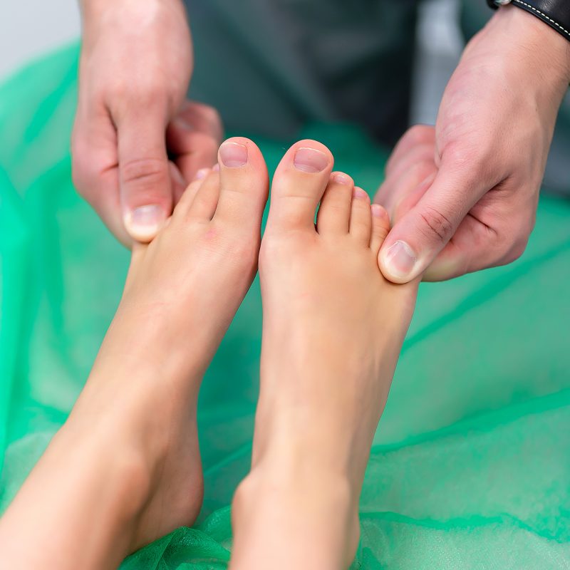 Is Toe Shortening Surgery Right for You? Key Considerations