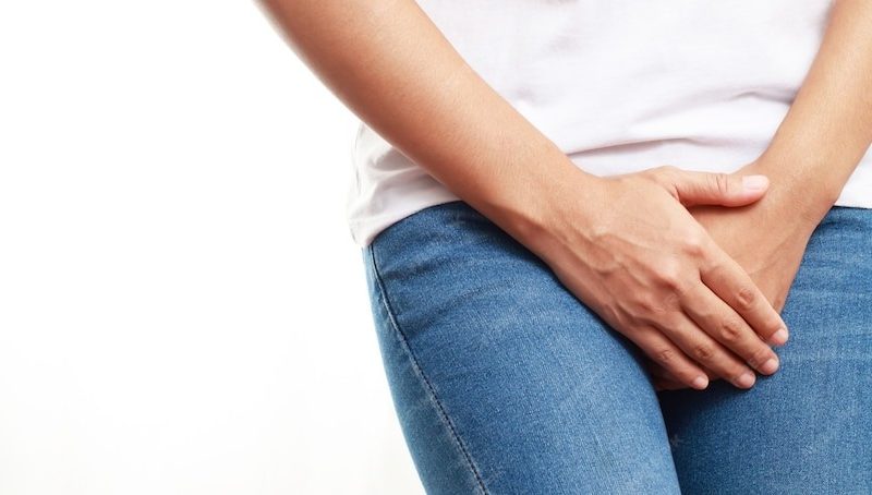 Condyloma Treatment