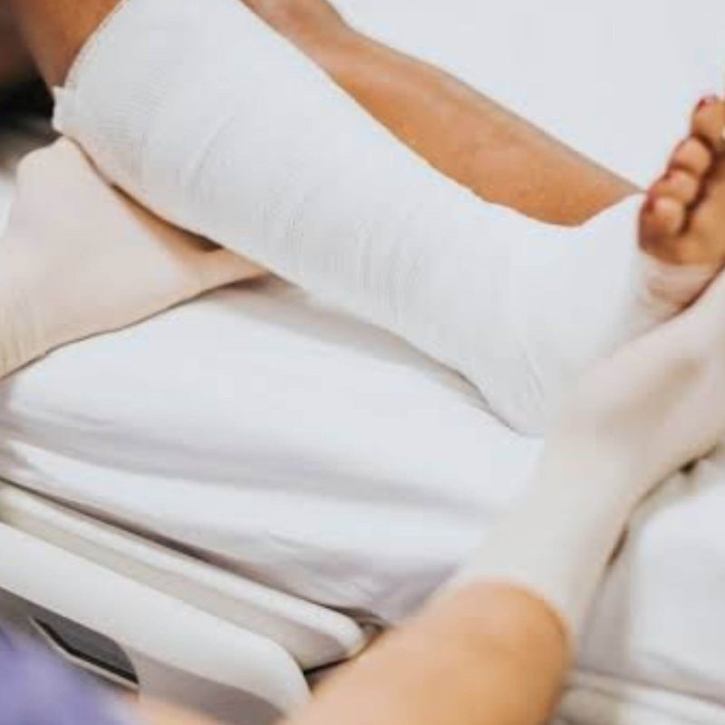Is Flat Foot Surgery Right for You Symptoms, Diagnosis & Solutions