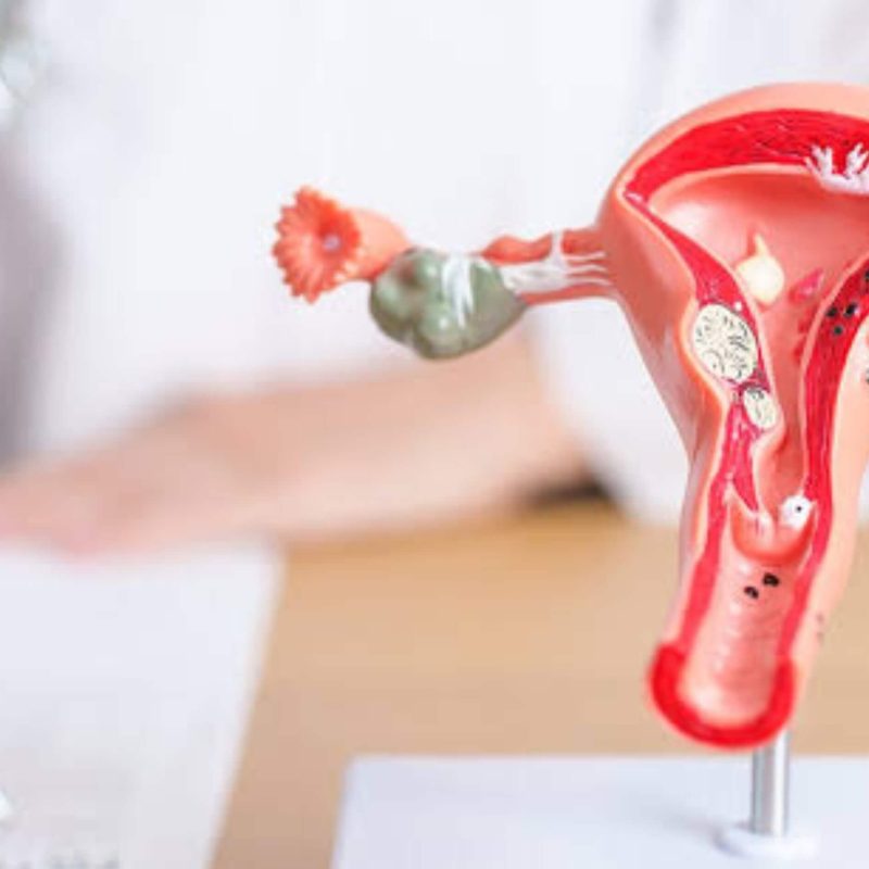 Understanding Appendectomy Surgery A Complete Guide