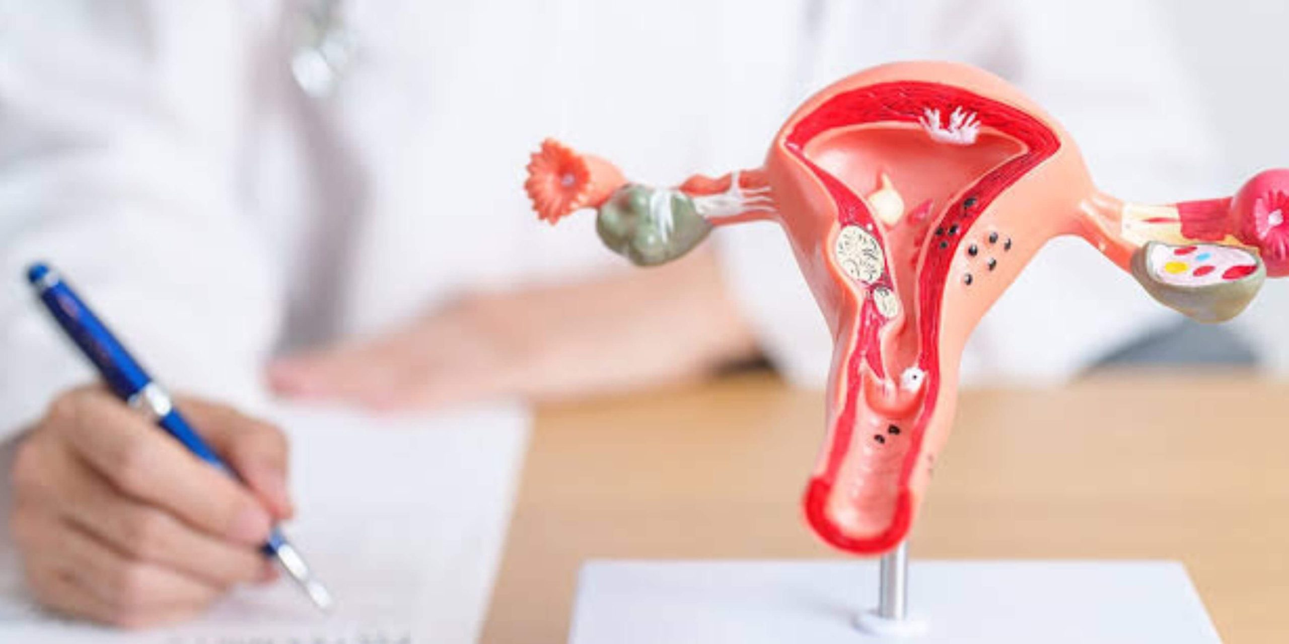 How to Find the Best Hysterectomy Surgeons: A Complete Guide
