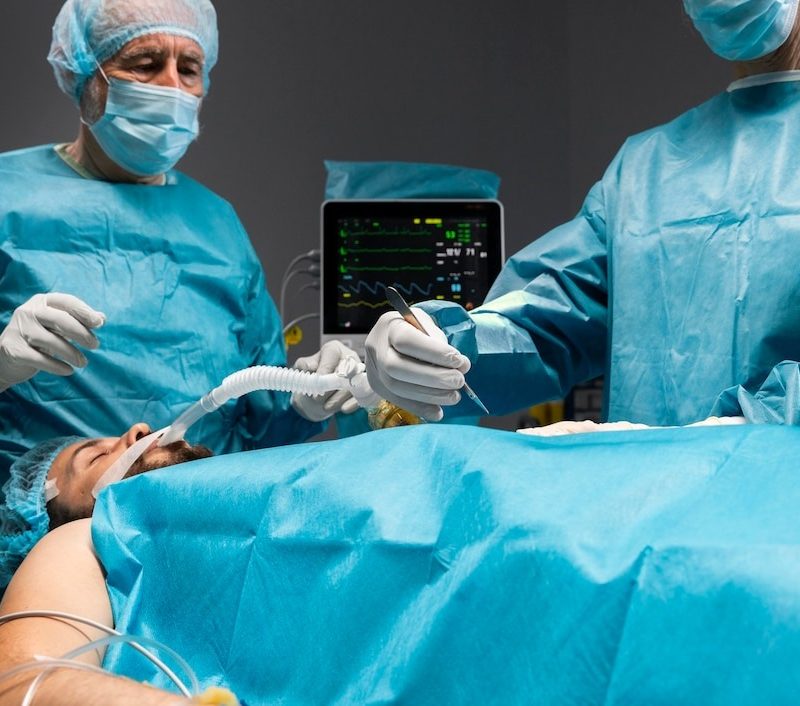 Varicocele Surgery