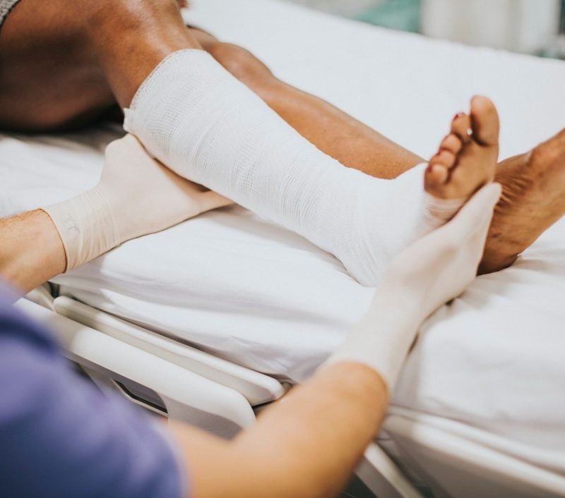 flat foot surgery
