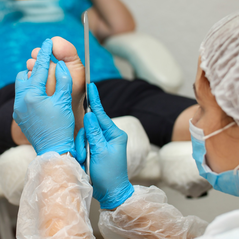 Cinderella Foot Surgery