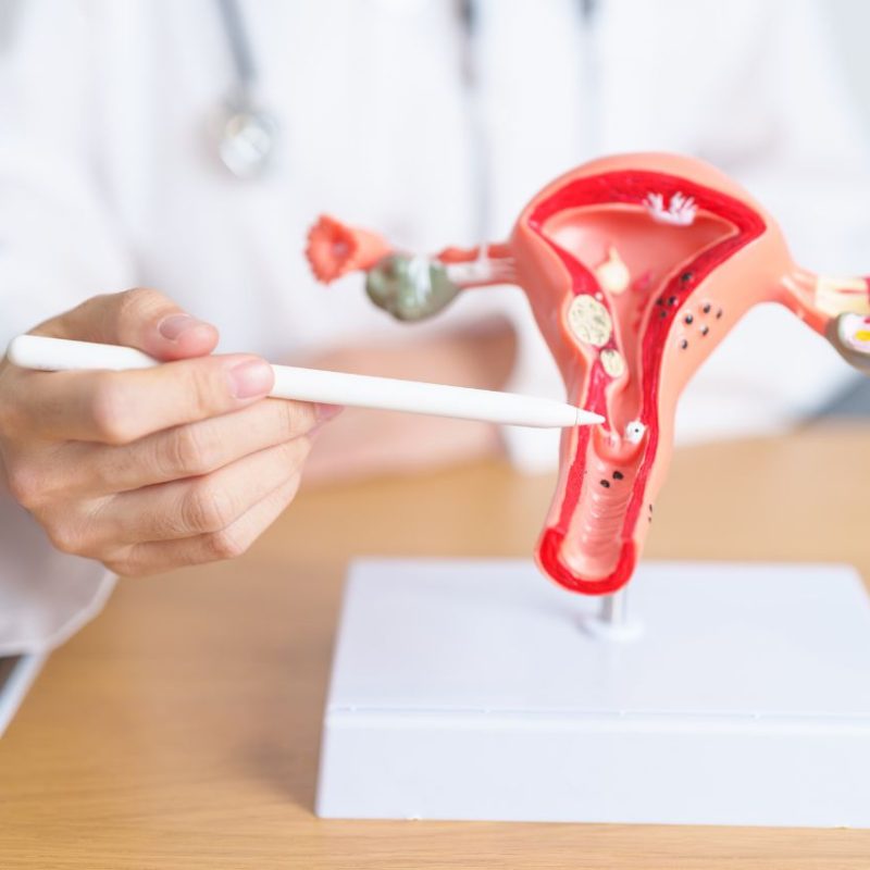 Finding the Best Hysterectomy Surgeons Tips for a Safe Surgery