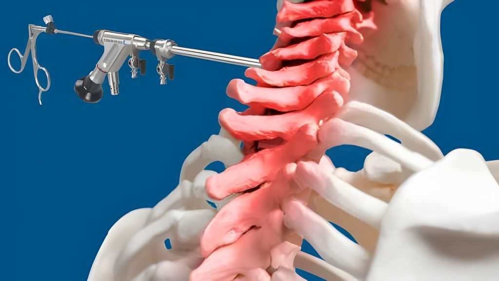 Disc Compression Treatment