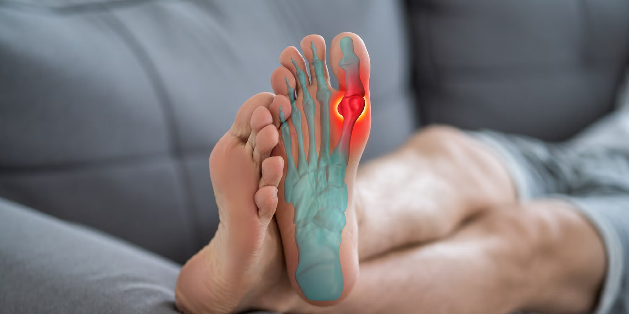 Hallux Rigidus Surgery Cost UK for Private Patients: Full Guide