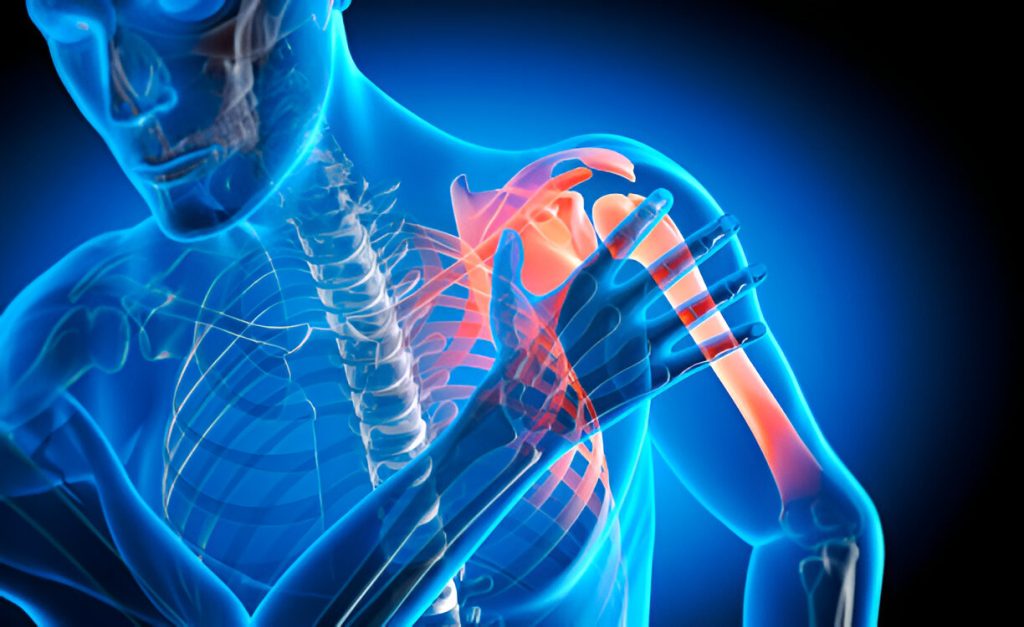 Shoulder Arthroscopy