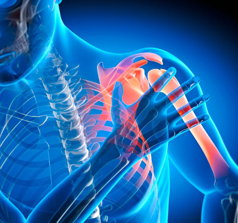 Shoulder Arthroscopy