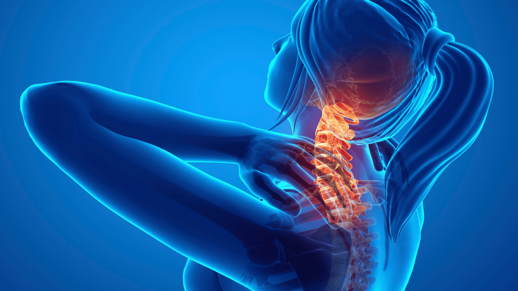 Cervical Disc Herniation